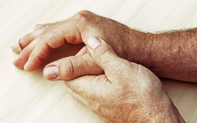 13 Hausmittel gegen geschwollene Hände