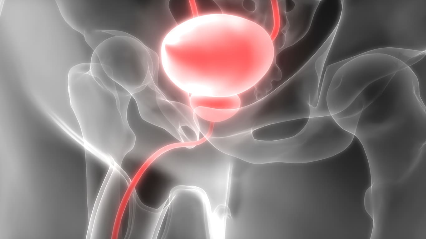 Maca und die Auswirkungen auf die Prostata